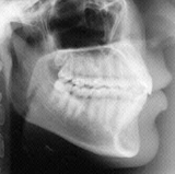 Radiologia Odontológica em Rio Grande